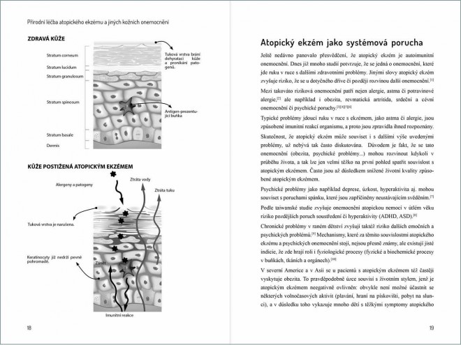 Atopický ekzém - náhled knihy